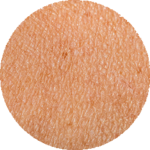 پوست مختلط (Combination Skin)