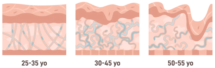 چروک پوست چطور به وجود می‌آید؟