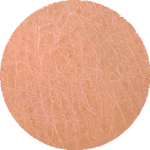 پوست خشک (Dry Skin)