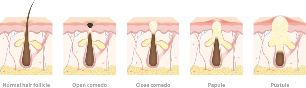 مراحل ایجاد جوش